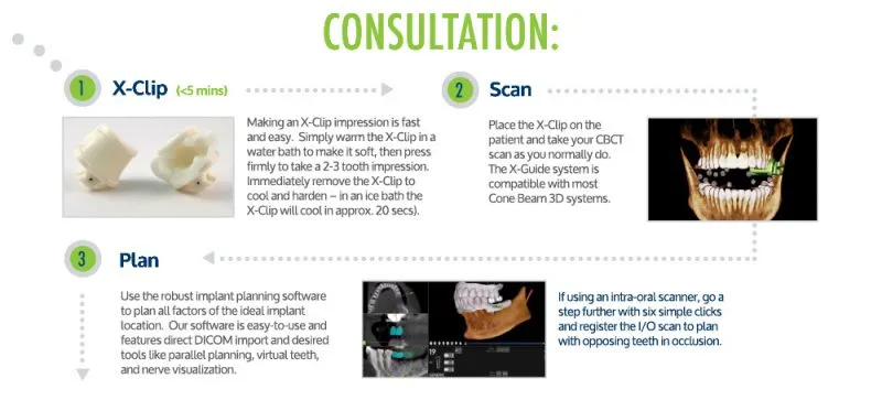Flow chart of navigational surgery process part one