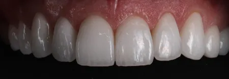 restorative dentistry case study