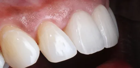 restorative dentistry case study