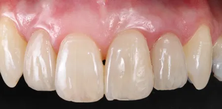 restorative dentistry case study