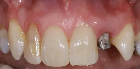 restorative dentistry case study