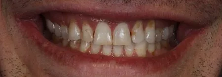 restorative dentistry case study